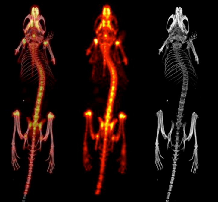 骨骼成像.png 骨骼成像.png