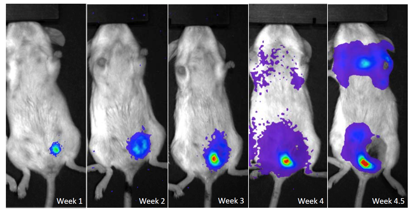 檢測癌癥轉(zhuǎn)移-1.png 檢測癌癥轉(zhuǎn)移-1.png