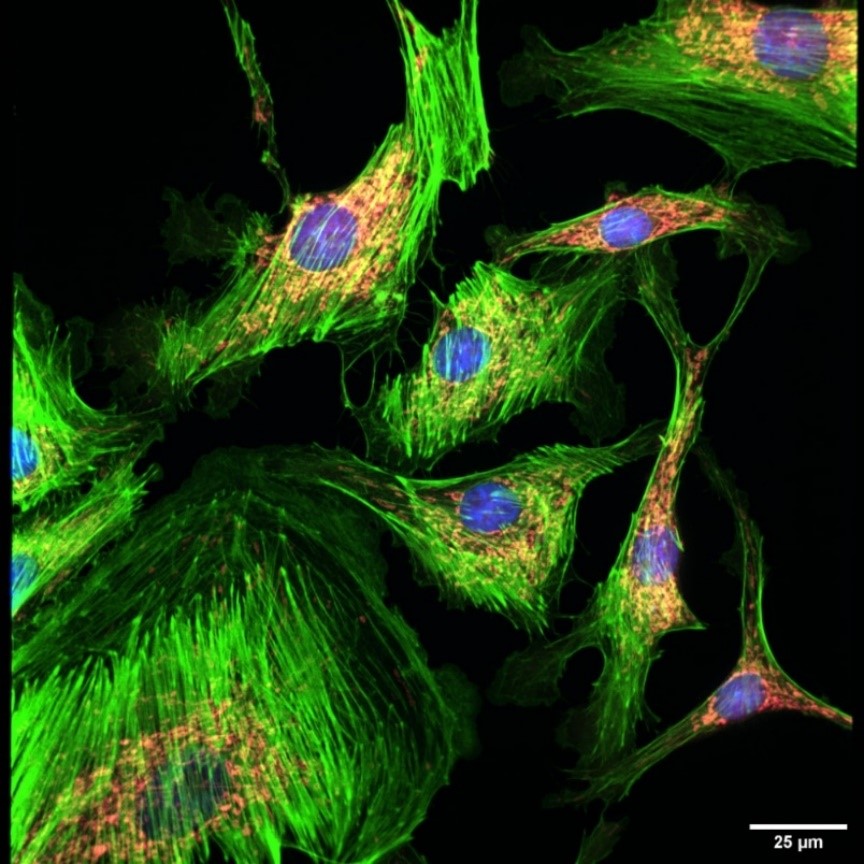 染色的BPAE細(xì)胞.jpg 染色的BPAE細(xì)胞.jpg