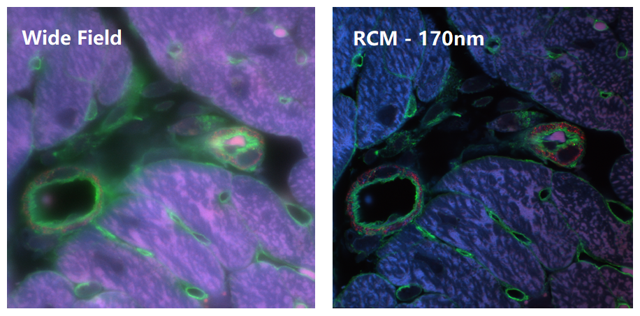 寬場(chǎng)和RCM的對(duì)比-2.png 寬場(chǎng)和RCM的對(duì)比-2.png