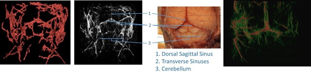 腦部血管成像.jpg 腦部血管成像.jpg