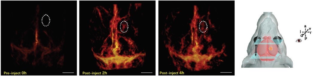生物納米探針腦內(nèi)原位腫瘤成像.jpg 生物納米探針腦內(nèi)原位腫瘤成像.jpg