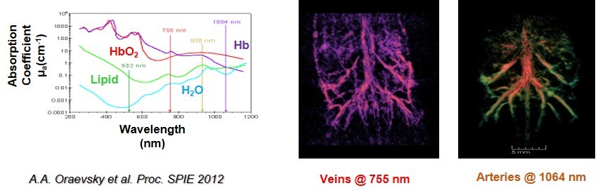 靜脈動脈成像.jpg 靜脈動脈成像.jpg