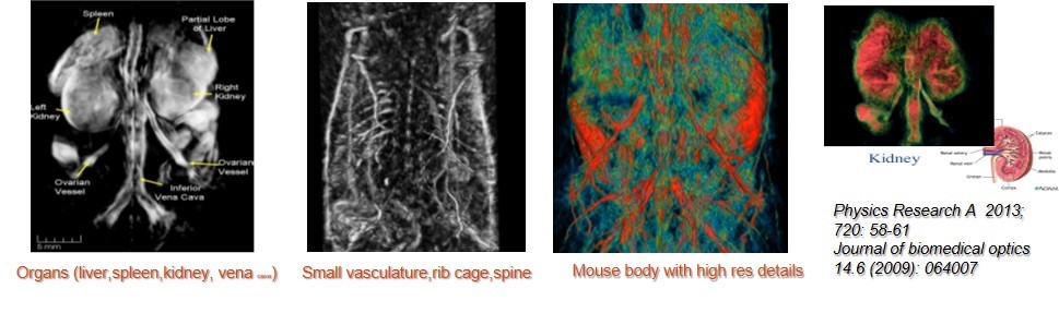 臟器及淺表血管成像.jpg 臟器及淺表血管成像.jpg
