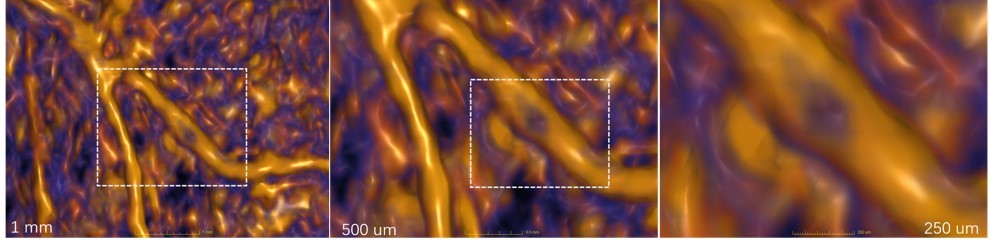微觀血管結(jié)構(gòu)成像.jpg 微觀血管結(jié)構(gòu)成像.jpg