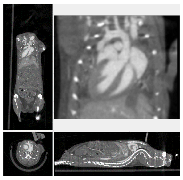 心臟門控成像.png 心臟門控成像.png