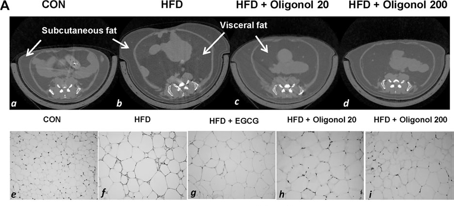 肥胖機(jī)制研究.png 肥胖機(jī)制研究.png