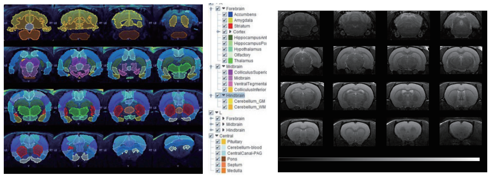 大鼠腦部RARE影像.png 大鼠腦部RARE影像.png