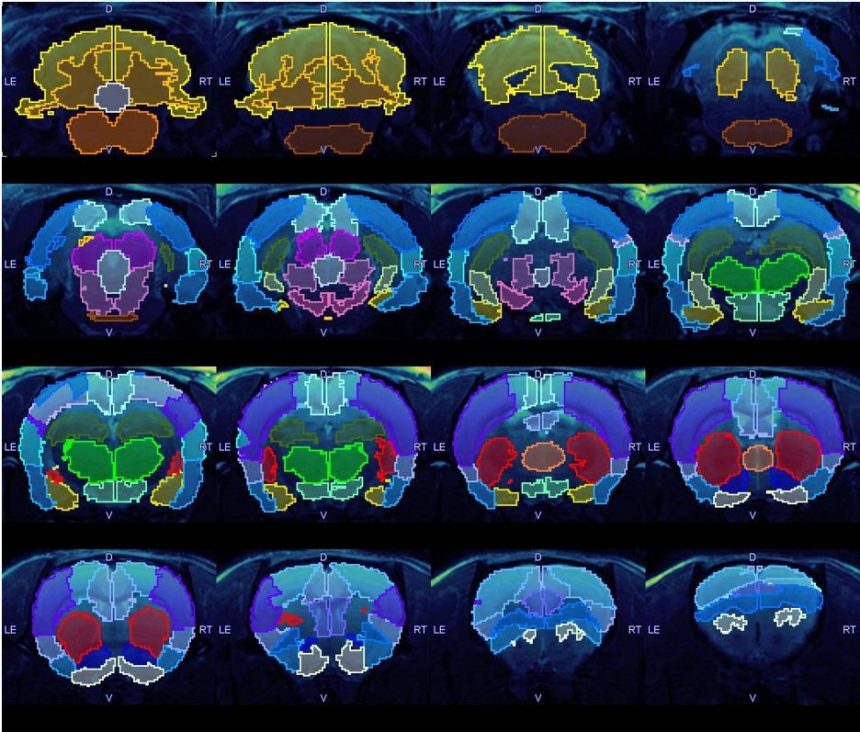 rat-brain-rare.jpeg rat-brain-rare.jpeg